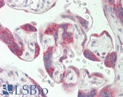 IHC-plus™ Polyclonal Rabbit anti-Human Cytochrome P450 2R1 / CYP2R1 Antibody (aa230-279, IHC, WB)