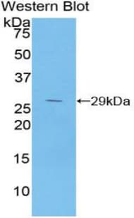 NFKBIB / IKB Beta / IKBB Antibody (aa117-345)