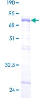 Human MBNL1 / MBNL Protein (Recombinant GST)