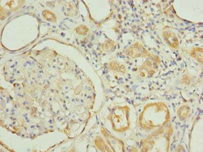 Polyclonal Rabbit anti-Human RNF31 Antibody (IHC)