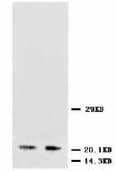 NTF3 / Neurotrophin 3 Antibody (Internal)