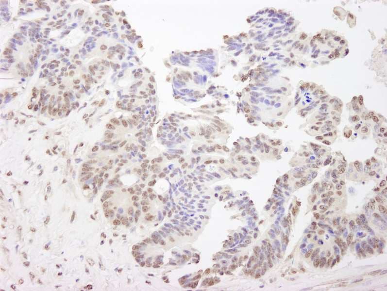 Polyclonal Rabbit anti-Human XPA Antibody (aa1-50, IHC)