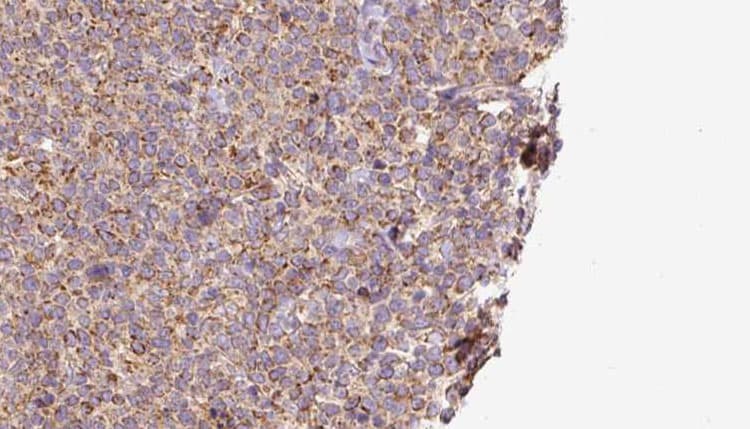 SLC10A2 / ASBT Antibody