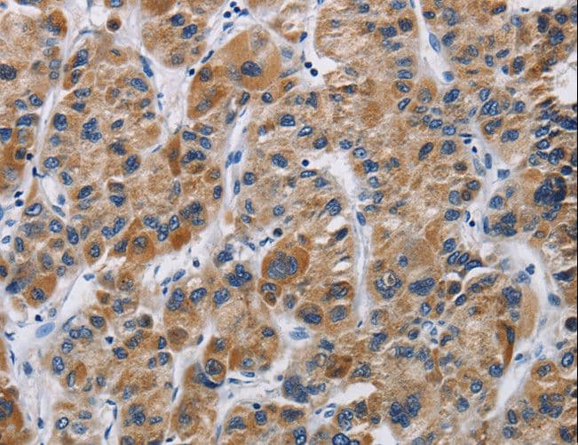 IFNGR2 Antibody