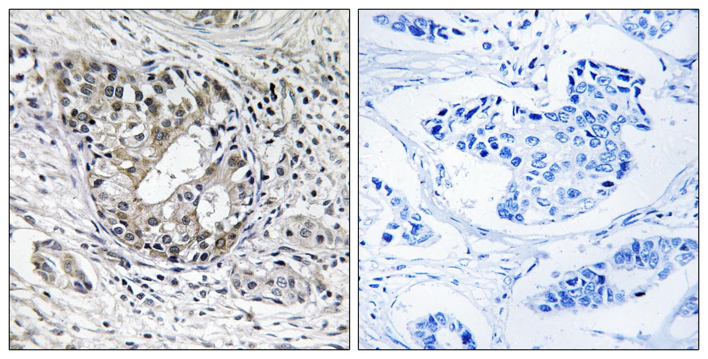 PNPT1 Antibody