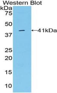 Osteocalcin Antibody (aa11-98)