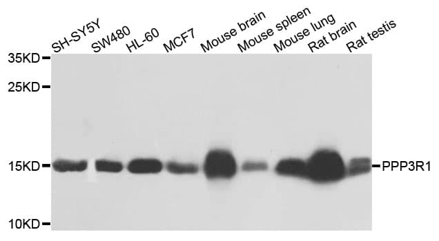 IHC-plus™ Polyclonal Rabbit anti-Human PPP3R1 / Calcineurin B Antibody (IHC, WB)