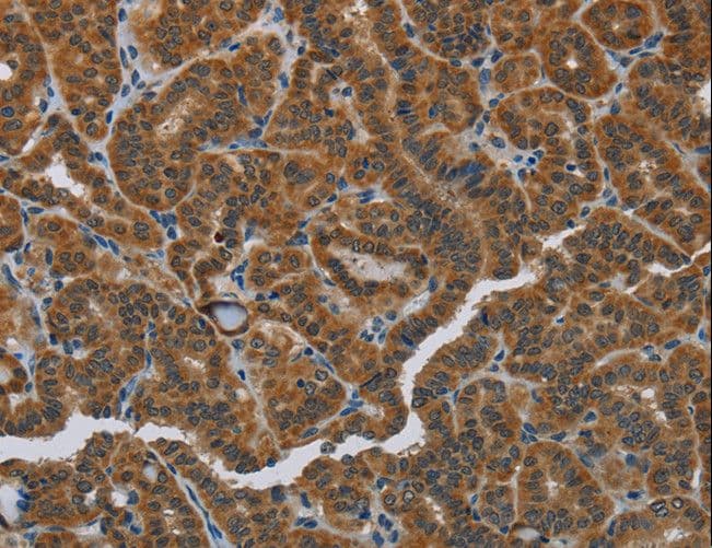 HSD3B7 Antibody