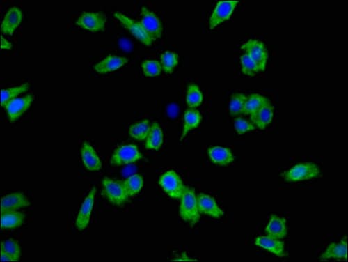 SLC6A3 / Dopamine Transporter Antibody