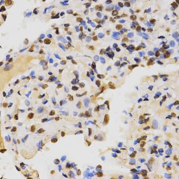 Histone H3 Antibody (Di-Methyl-Lys36)
