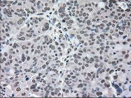 MAP2K2 / MKK2 / MEK2 Antibody (clone OTI8G6)