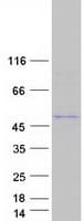 Human TMPPE Protein (Recombinant Myc-DDK (Flag))