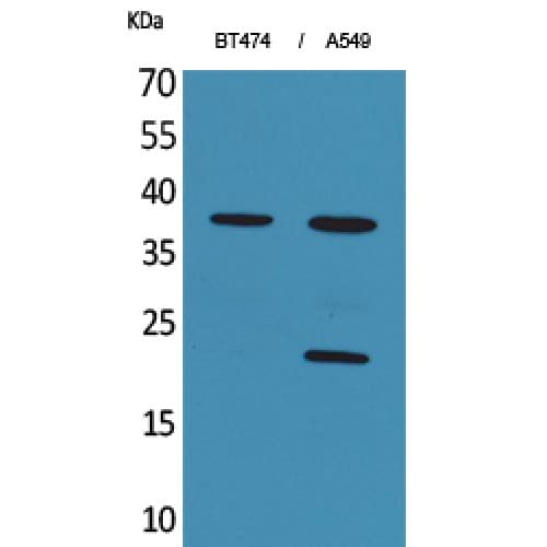 Polyclonal Rabbit anti-Human IFNA1 / Interferon Alpha 1 Antibody (C-terminal, WB)