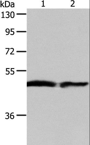 Polyclonal Rabbit anti-Human AADAC Antibody (IHC, WB)