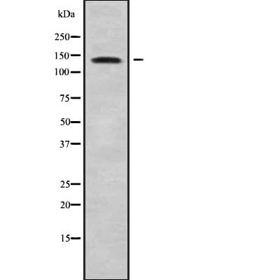 PRDM10 / TRIS Antibody