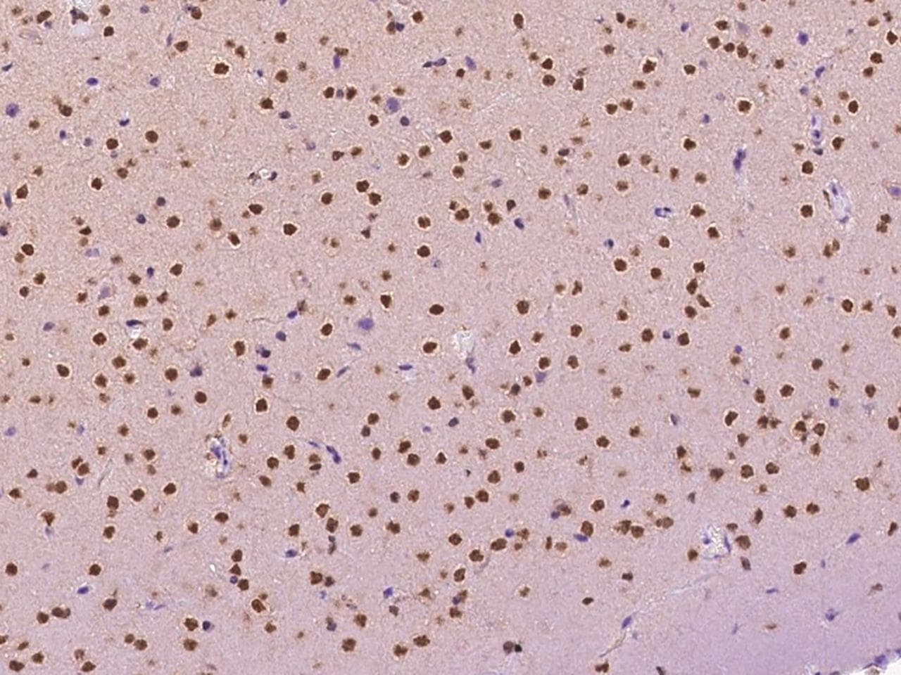 Hypothetical Protein / TINP1 Antibody