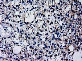 GCKR Antibody (clone OTI1E7)