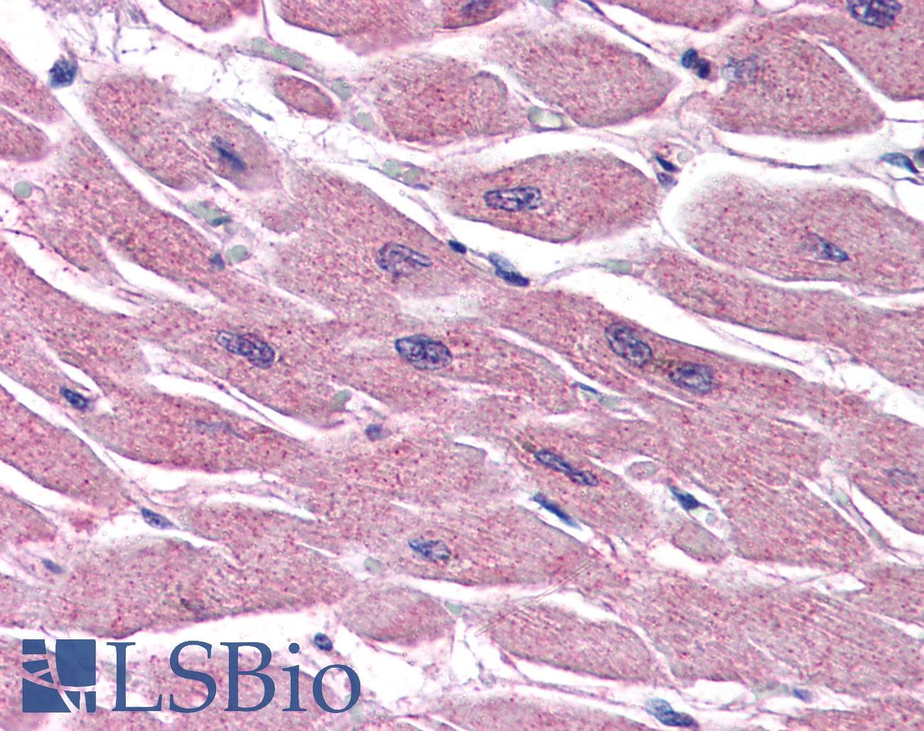 IHC-plus™ STRADB / ALS2CR2 Antibody (aa406-418)