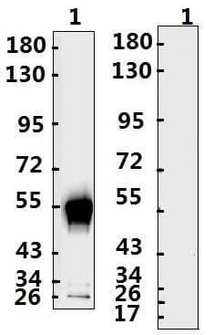 SARS-CoV-2 Nucleoprotein Antibody