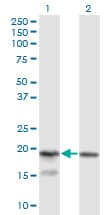 KLRC4 Antibody (clone 1D10)