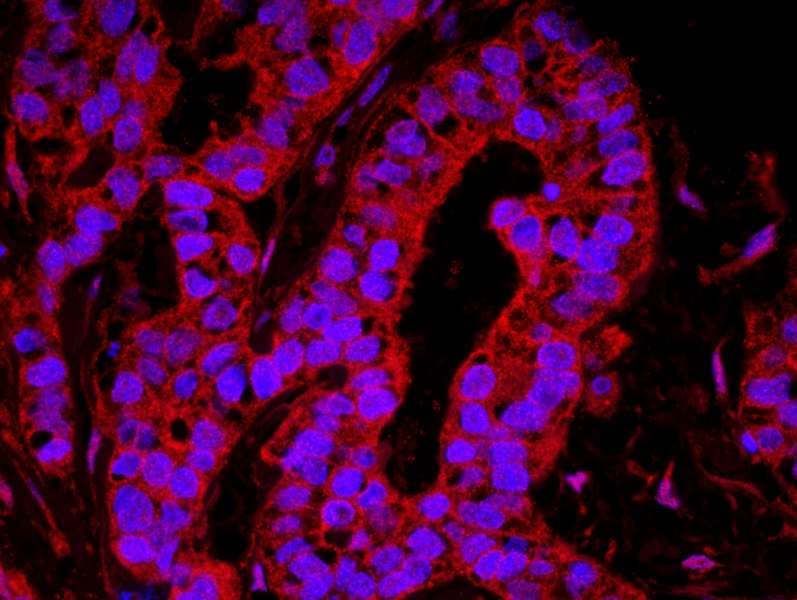 IHC-plus™ YAP / YAP1 Antibody (aa350-400)