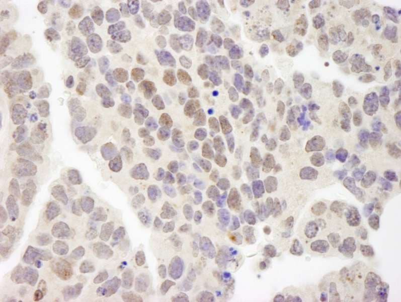 Polyclonal Rabbit anti-Human ZMYM3 Antibody (aa250-300, IHC)