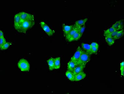 RPS29 / Ribosomal Protein S29 Antibody