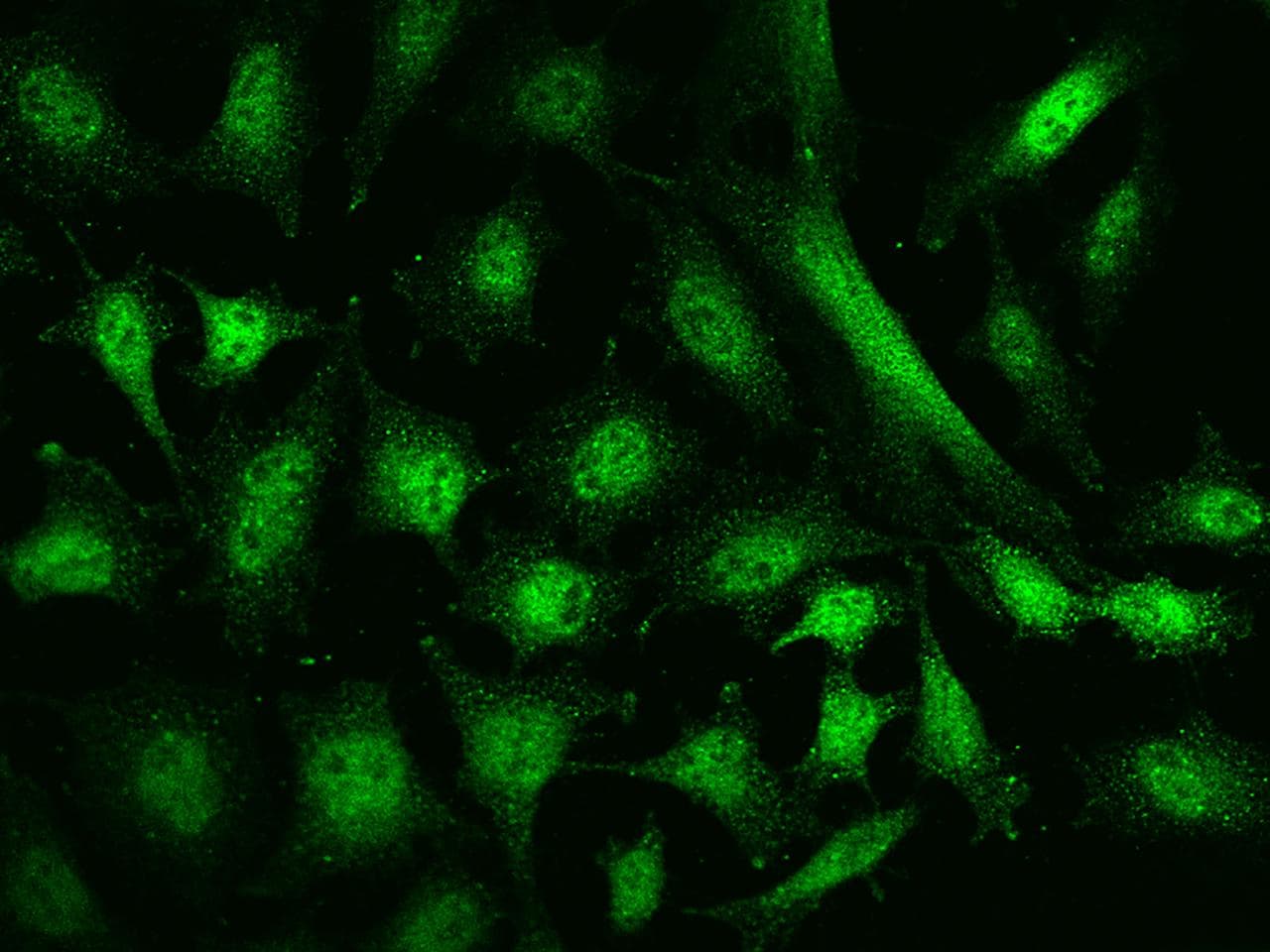 N-CoR / NCOR1 Antibody
