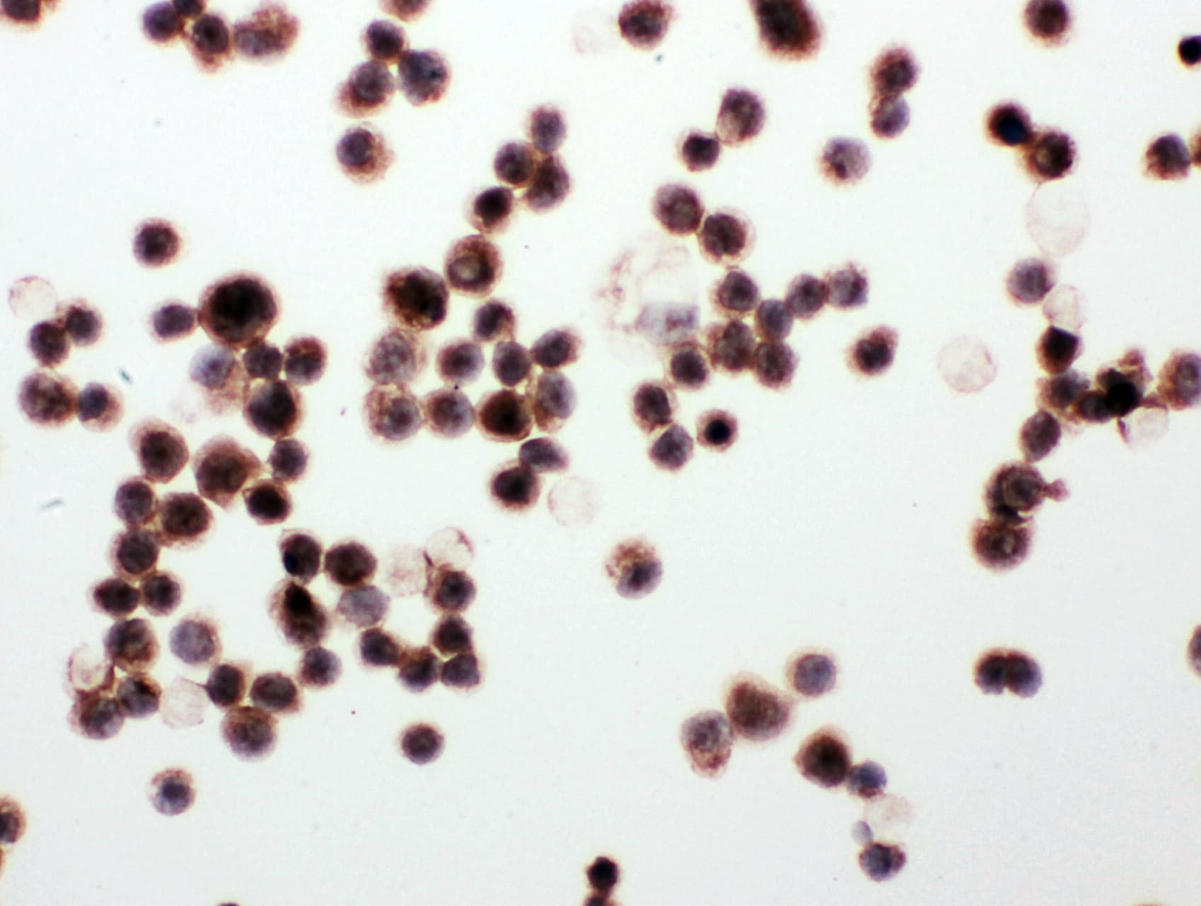 CCN4 / WISP1 Antibody (aa354-367)