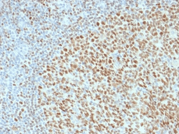 Monoclonal Mouse anti-Human POU2F2 / OCT2 Antibody (clone OCT2/2136, IHC)