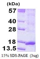 Human ORAOV1 Protein (Recombinant His)