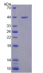 Mouse DEFA1 / Defensin Alpha 1 Protein (Recombinant His-GST)