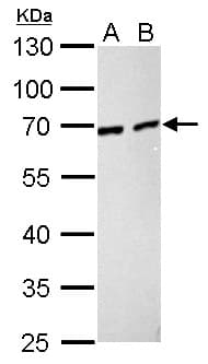 NUP62 Antibody (aa294-522)