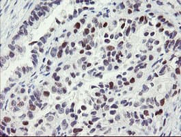 RFC2 / RFC40 Antibody (clone OTI4C11)
