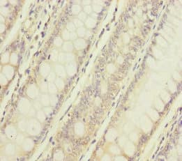 NAA25 Antibody