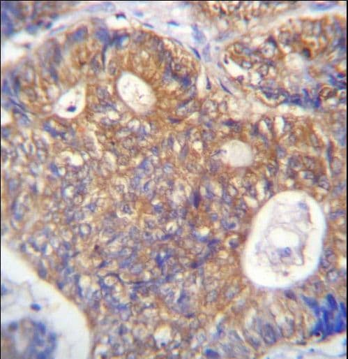 PAICS / ADE2 Antibody (aa95-123)