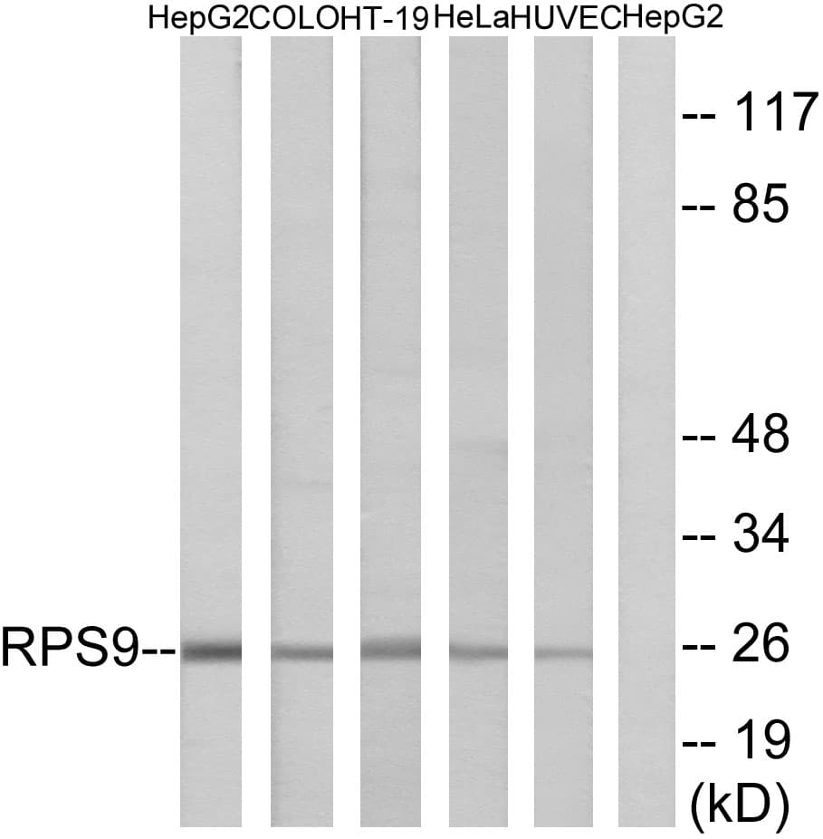 RPS9 / Ribosomal Protein S9 Antibody (aa31-80)