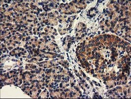 Monoclonal Mouse anti-Human HDAC6 Antibody (clone OTI1B3, IHC, IF, WB)