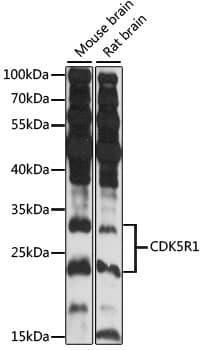 Polyclonal Rabbit anti-Human CDK5R1 Antibody (IF, WB)