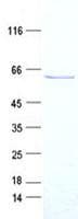 Human RAD52 Protein (Recombinant Myc-DDK (Flag), C-terminus)