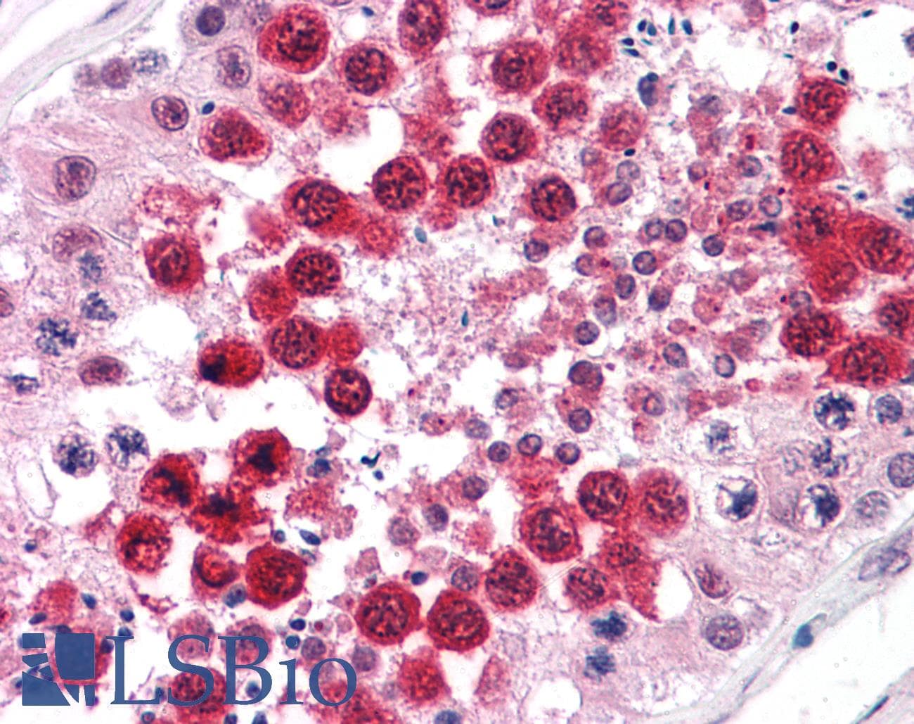IHC-plus™ IPP2 / PPP1R2 Antibody (clone 2E9)