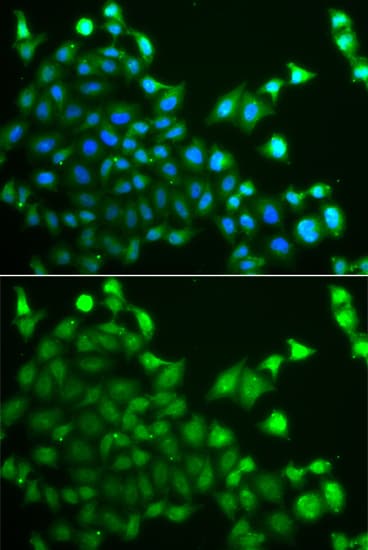CBLC Antibody