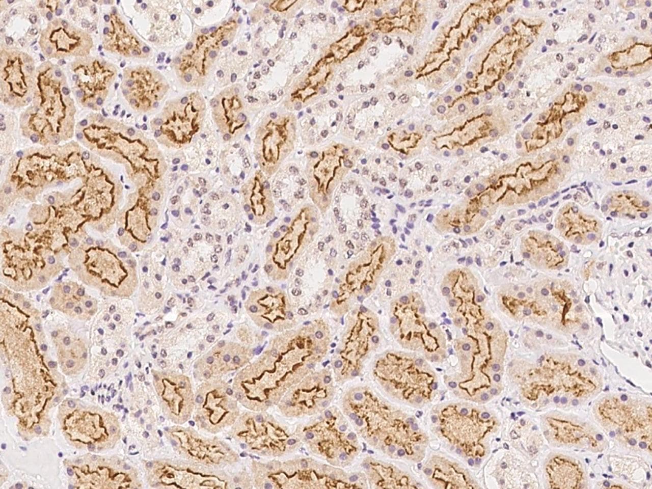 HOXB9 Antibody