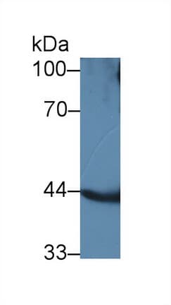 ACADL Antibody