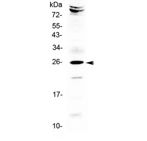 SRY Antibody