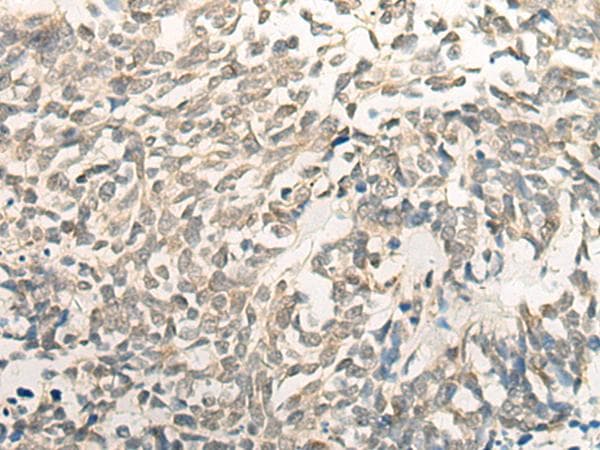 BCAS3 Antibody