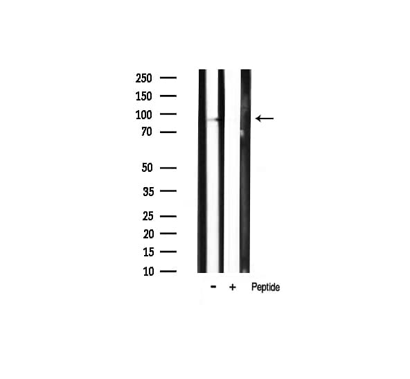 PIK3R1 / p85 Alpha Antibody (phospho-Tyr607)
