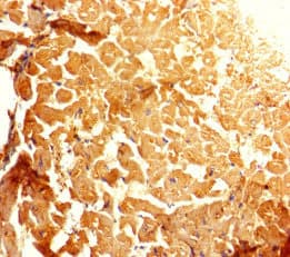 GALM / Mutarotase Antibody