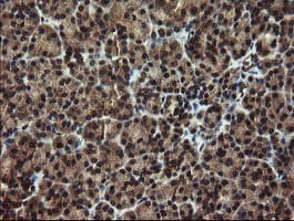 DOK7 Antibody (clone OTI1A9)