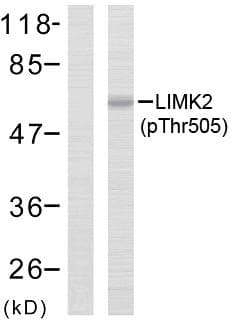 Polyclonal Rabbit anti-Human LIMK2 Antibody (phospho-Thr505, IHC, WB)
